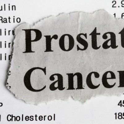 An overview of prostate cancer