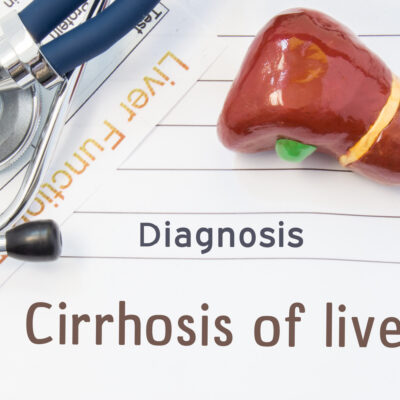 All you need to know about cirrhosis of the liver