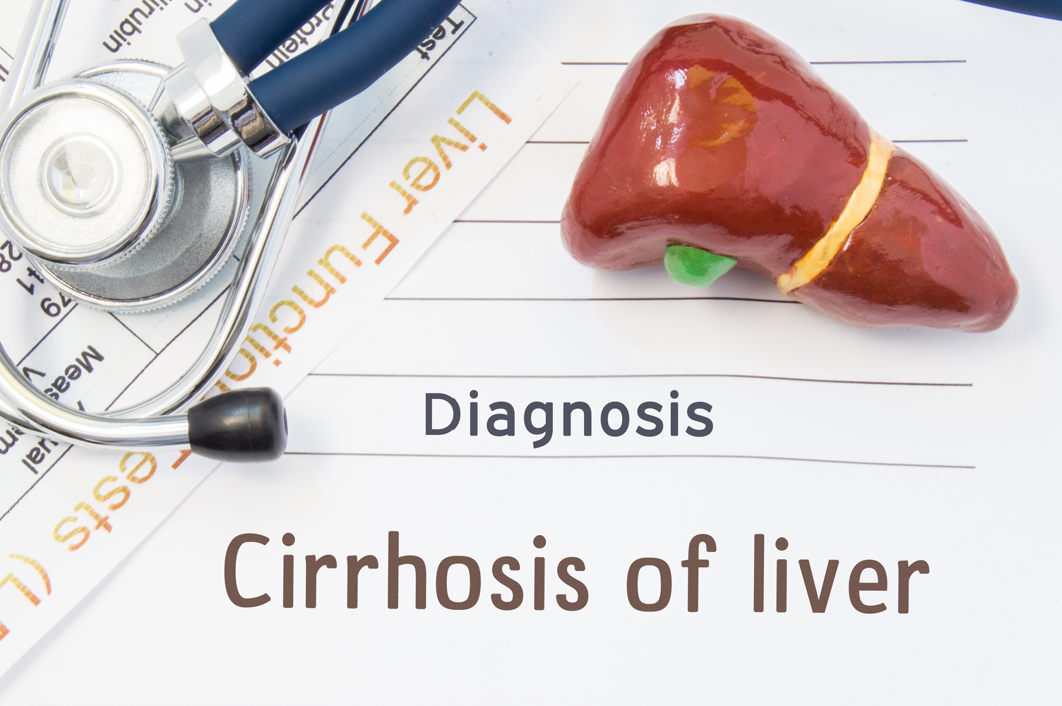 All you need to know about cirrhosis of the liver