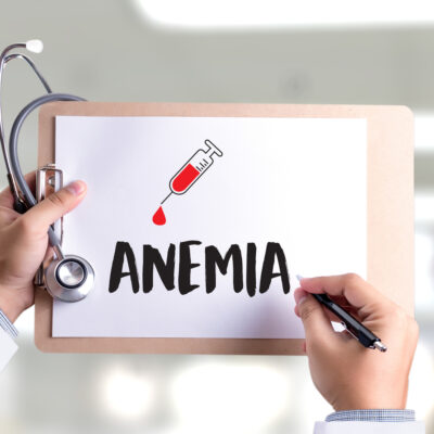 All you need to know about iron deficiency anemia