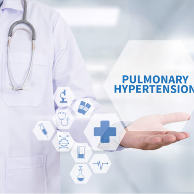 Frequently asked questions about pulmonary hypertension