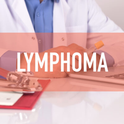 How to treat non-Hodgkin’s lymphoma