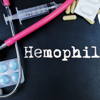 Stages and severity of hemophilia