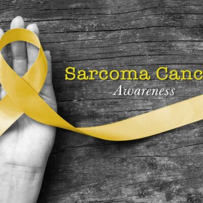 Symptoms and treatment of Kaposi&#8217;s sarcoma in AIDS and HIV