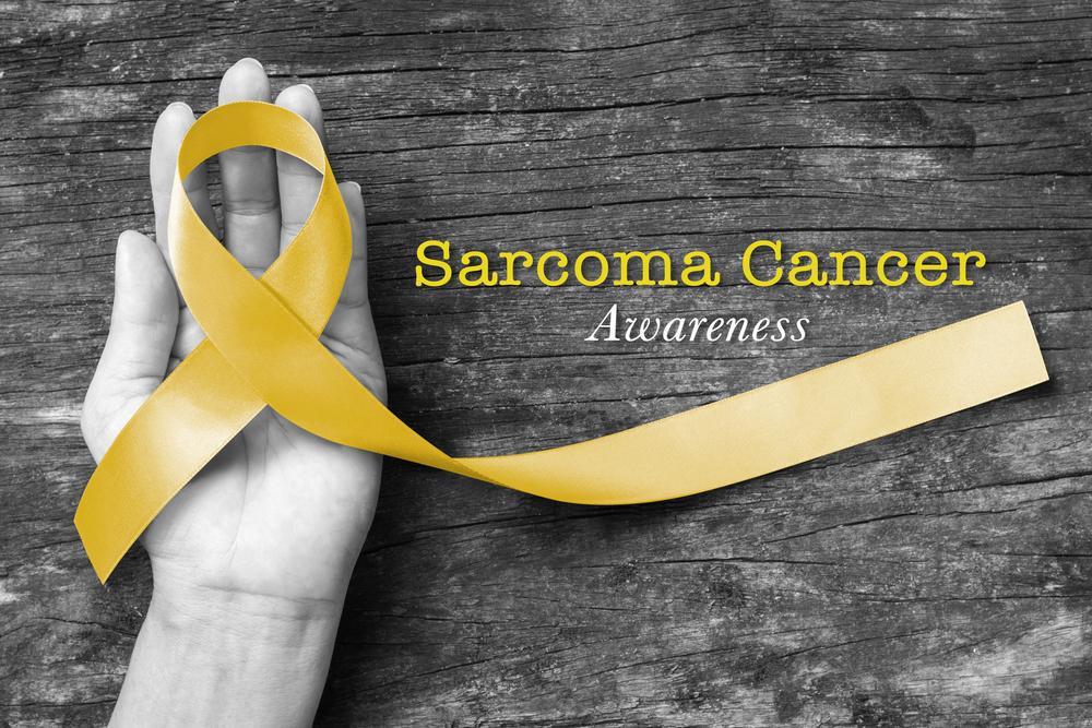 Symptoms and treatment of Kaposi&#8217;s sarcoma in AIDS and HIV