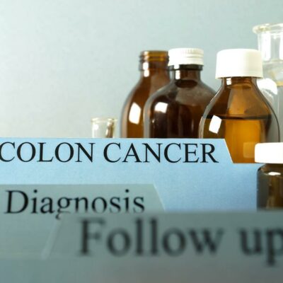 The risk of getting colon cancer and how to prevent it