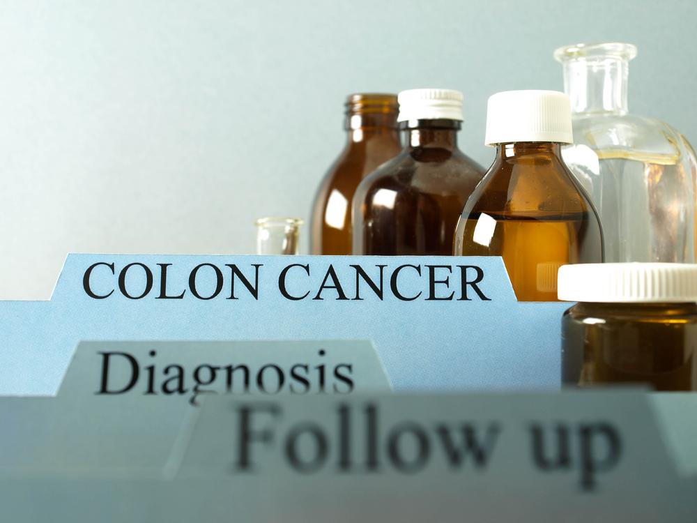 The risk of getting colon cancer and how to prevent it