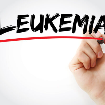 Treatment options available for leukemia