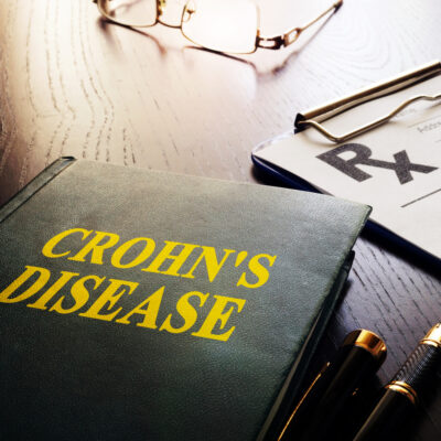 Treatment for Crohn’s disease